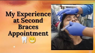 Second Braces Visit: Jo Maine Expect Nahi Kiya 😬 My experience #bracesjourney #braces #bracespain