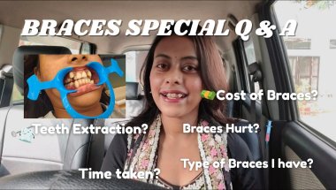 Answering All Your Questions Related To *BRACES*🦷 || cost, pain, extraction process, experience