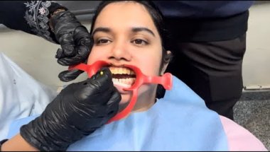 4th Time Braces Appointment😤 | Lower Teeth Braces Reality🥶😭 || 15J.26