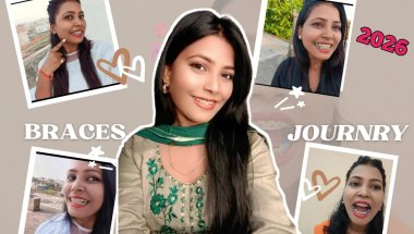 😍 BRACES JOURNEY Changes Transformation 🔥 ll Braces Transformation Video 2026#braces