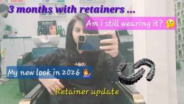 3 months retainer update 😬| My new look in 2026 ❤️🤳 #aligners #braces #retainers #teeth #dentalcare
