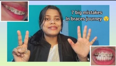 Braces Lagwane ke Baad Ye 7 Galtiyaan Mat Karna 😬 | Honest Braces Advice #BracesJourney #Braces