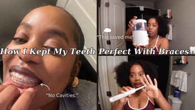 “How I Took Care of My Teeth With Braces | My Full Routine for a Healthy