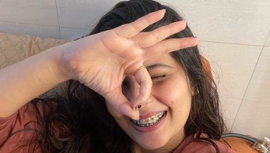11 Months braces journey/Cost/painDiscomfort #viral #teeth #trending #dentalcare #braces #viralvideo