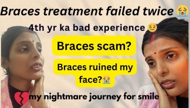 2.	Braces लगवाने की सबसे बड़ी गलती? मेरा Worst Experience😭 | Honest & Real Experience