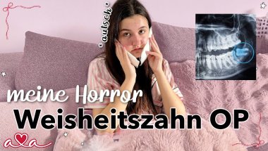 es war so schlimm :( meine Weisheitszahn OP und der Horror danach ౨ৎ Alles Ava