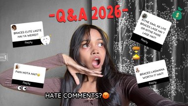 Things people ask when they see my braces 🦷😨| answering common questions ?😮‍💨