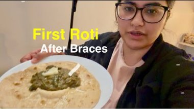 Braces Ke Baad Pehli Baar Roti Khayi 😬 | Real Braces Experience