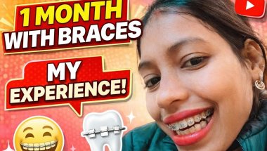 1 month with braces journey 🦷 honest review #braces #vlog #dentalcare #tranding