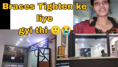 Braces Tighten ke liye gyi 12 months complete hogye 🙂😁#like #braces #longvideo #vlog #share #comment