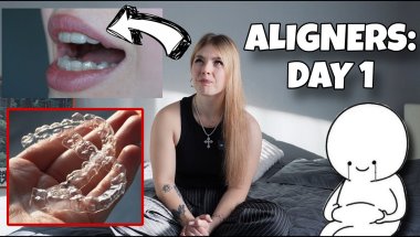 СКОЛЬКО Я ЗАПЛАТИЛА ЗА ЭЛАЙНЕРЫ?- ЦЕНА, УХОД И КОМФОРТ/ HOW MUCH I PAID FOR ALIGNERS —CARE & COMFORT