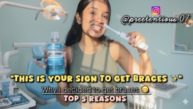 My braces journey & experience from the last 6 months 🦷✨#viral #braces #dentist #dentalhealth #cost