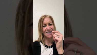 #adultorthodontics Braces are on! @orthomikeorthodonticstv9749
