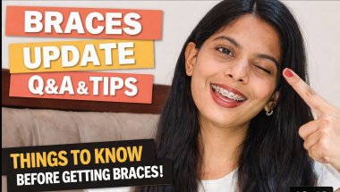 Braces Update After 2nd Appointment 😍 | Braces Journey in Hindi | My Real Experience #braces #comedy