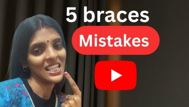 Braces Treatment Mein Ye 5 Galtiyan Mat Karna!|My braces journey