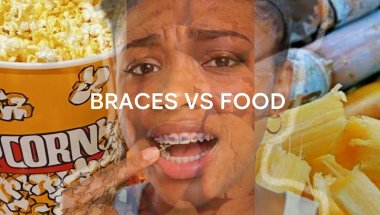 FOOD/SNACKS TO AVOID WHILE YOU STILL GOT ON BRACES