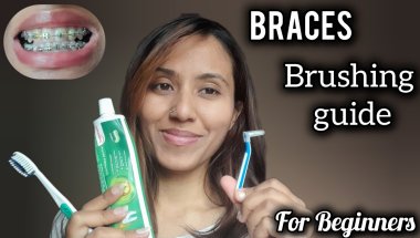 How to Brush Your Teeth with Braces | Step-by-Step for Beginners/ My braces journey #braces #viral