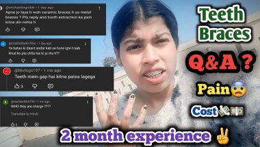 Things people ask when they see my braces😬🦷|| answering questions? #vlog #viral #dentist #subscribe.