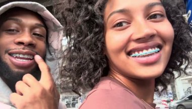 I Got Braces in Thailand… This Was NOT What I Expected 😳🇹🇭