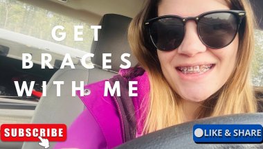 Got braces!!! ❤️