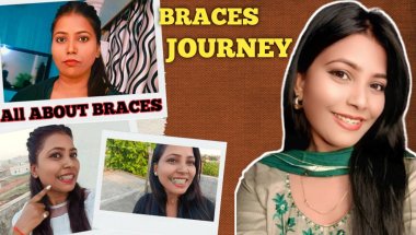 🦷😍 Life With Braces ll  Braces Q&A l Beginner Must Watch #braces #bracesjourney