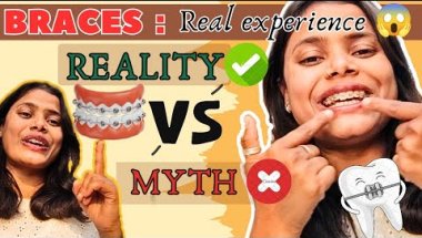 I Tried Brace Myths YouTubers Made Up