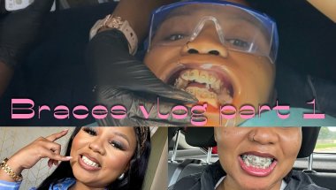 Vloggy Vlog: Lets go get Braces | Adult braces journey Part 1| #roadto1k #sayoutuber #keamaggz
