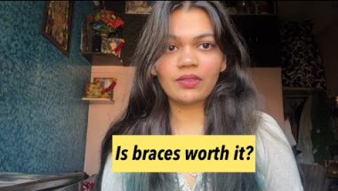 I Got Braces…This Is What No One Tells You 😳 | My Personal Experience