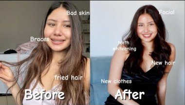 MY HUGE GLOW UP FOR 2026 | hair dyed, braces off, facial, hair removal, working out.￼