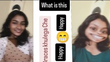 Ooooo #happy braces khulega acche