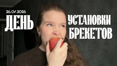 День установки брекетов 😎