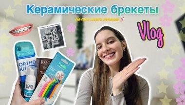 Влог✨Керамические брекеты.Начало лечения💅🏻