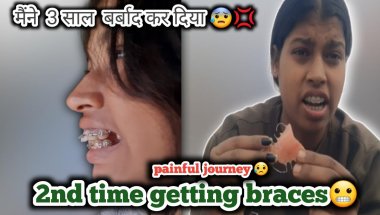 Second time braces😬| My braces experience #dentist #viral #vlog #subscribe.....