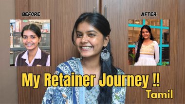 Life After Braces 😬 | Retainer Journey 2.0 | What No One Tells You in TAMIL #braces #retainers