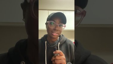 3 Days Post-Braces at 34