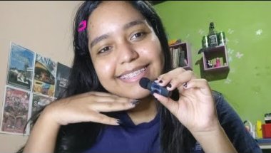 Falando sobre meu aparelho fixo! 😁✨