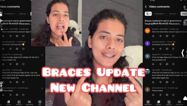 Braces Update | So Many DMs About My Braces! #braces #bracestreatment  #bracesupdate #information