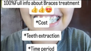 Braces treatment full information 🙏 follow and subscribe for more info 😍#bracestreatment#braces