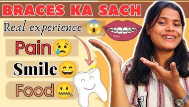 Braces lagwane se pehle ye sach jaan lo 😬 | Pain, food, smile & real experience #braces #viral