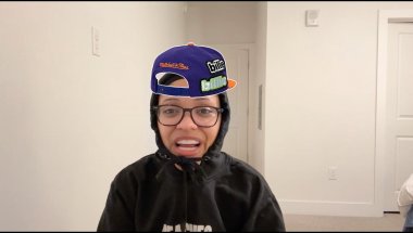 i have taken out my invisalign and this is the video  [nightcap]