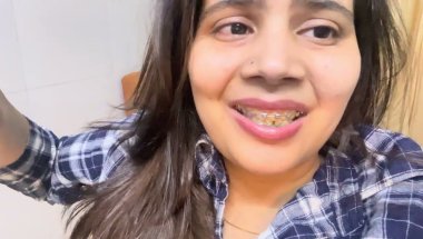 Kya Emi pe braces lagwana chahiye #viral #trending #dentalcare #teeth #viralvideo #braces #youtube