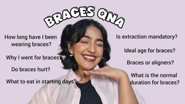 Everything you need to know about braces | Braces QnA  🦷