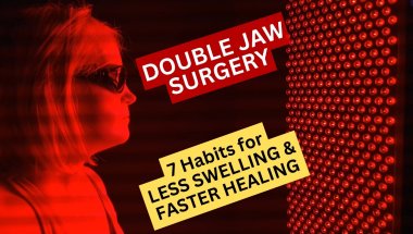 How I Reduced Swelling FAST After Jaw Surgery (My Layered Recovery Protocol)