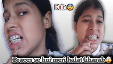 Braces se hui meri halat kharab🤯😰|| Painful 😪🦷#dentist #vlog #viral #transformation #subscribe....
