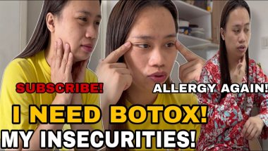 MY INSECURITIES! I NEED BOTOX! MAY SKIN ALLERGY DAHIL SA CREAM! LIVING ALONE VLOG! Abengvlogs
