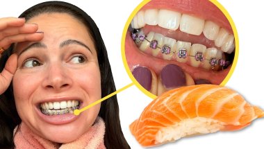 i unexpectedly got braces. let's eat sushi.