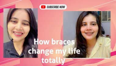 How braces change my life totally🦷😲 #viral #trending #teeth #dentalcare #viralvideo #braces #smile