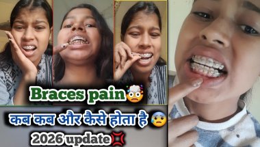 || Braces pain || कब कब और कैसे होता है 🤯💢😬#dentist #vlog #viral #subscribe...