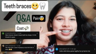 Braces Q&A💢|| BEFORE & AFTER || LIFE CHANGING BRACES TRANSFORMATION || 2 साल में कितने Changes हुए?