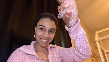 Your retainer questions | you asked, I answered